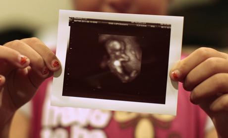 ultrasound photo