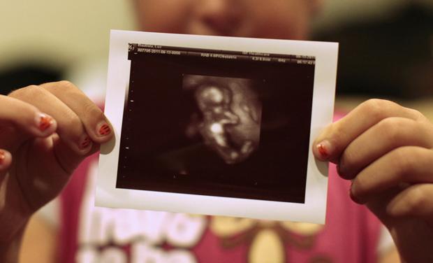 ultrasound photo